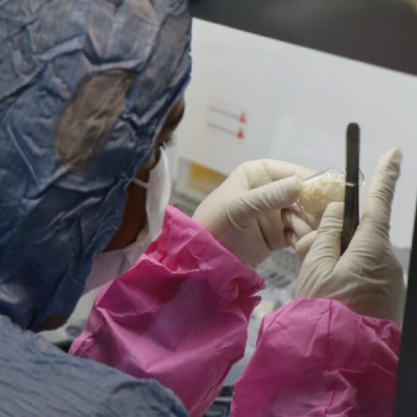 پردازش آلوگرافت ۱