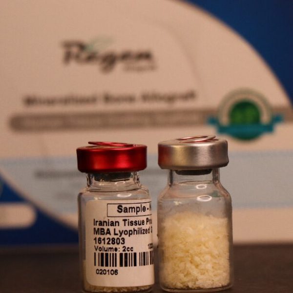 نمونه محصول آلوگرافت