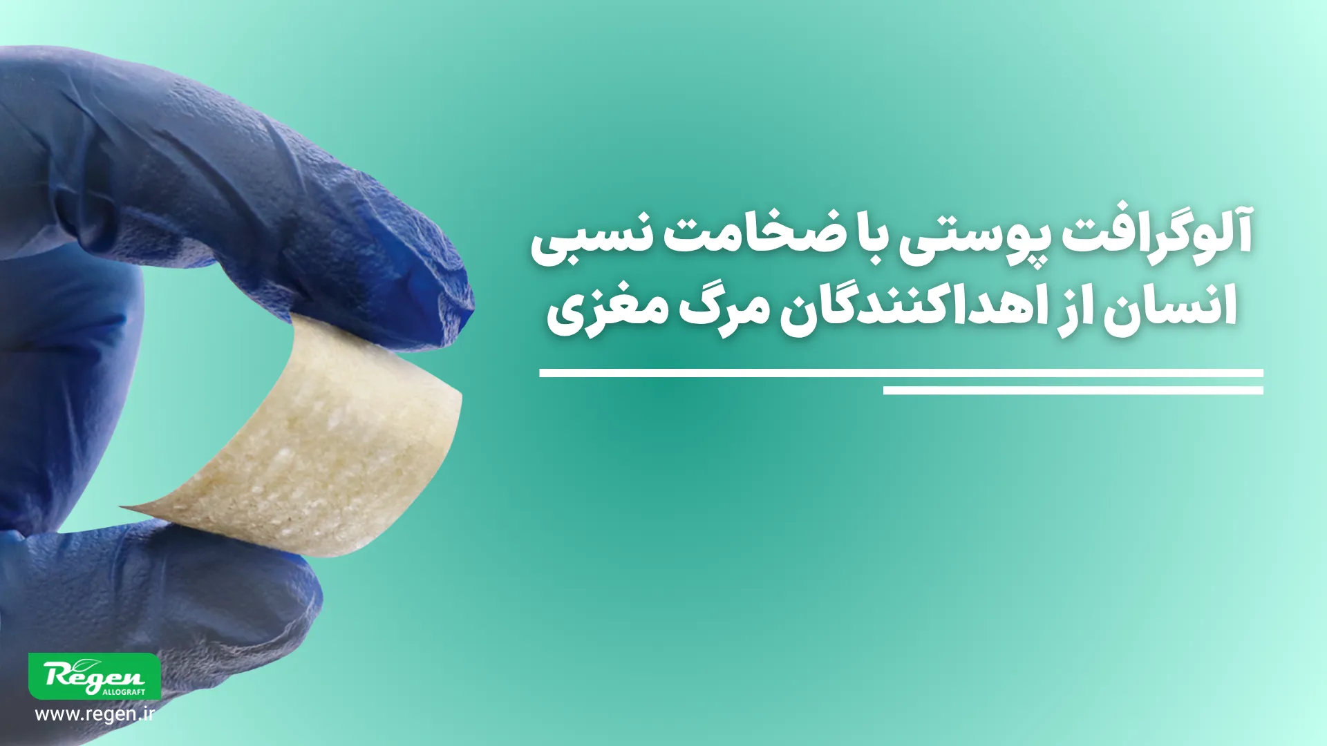 الوگرفت پوستی