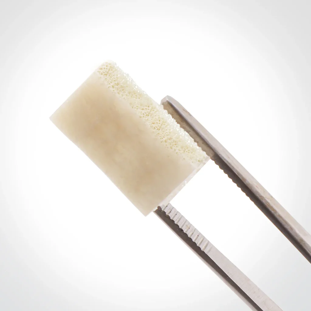 آلوگرفت بلاک استخوان