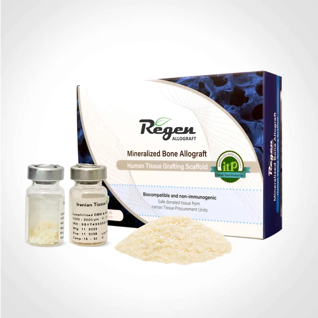 گرانول استخوان آلوگرفت 1000 تا 2000 میکرون