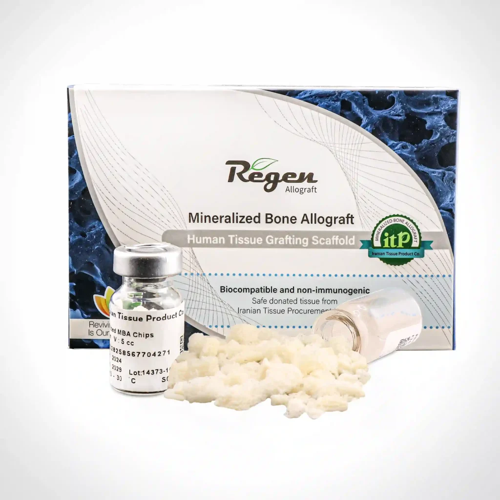 بیومتریال چیپس استخوان کنسلوس Allograft Bone Chips