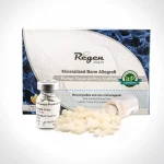 چیپس استخوان کنسلوس Allograft Bone Chips