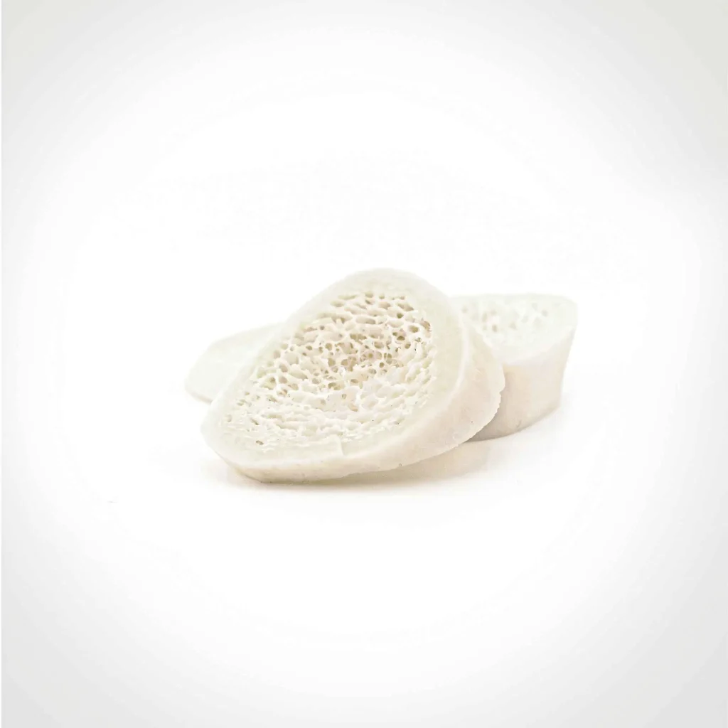 پیوند استخوان گوهای وج استخوان تیبیال - مناسب برای بازسازی و ترمیم استخوانها