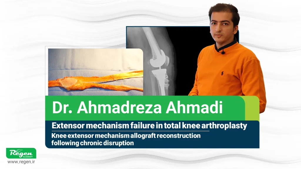 بازگرداندن عملکرد زانو پس از آرتروپلاستی کامل زانو (TKA) و تعویض مفصل زانو