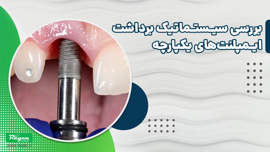 خارج سازی ایمپلنت