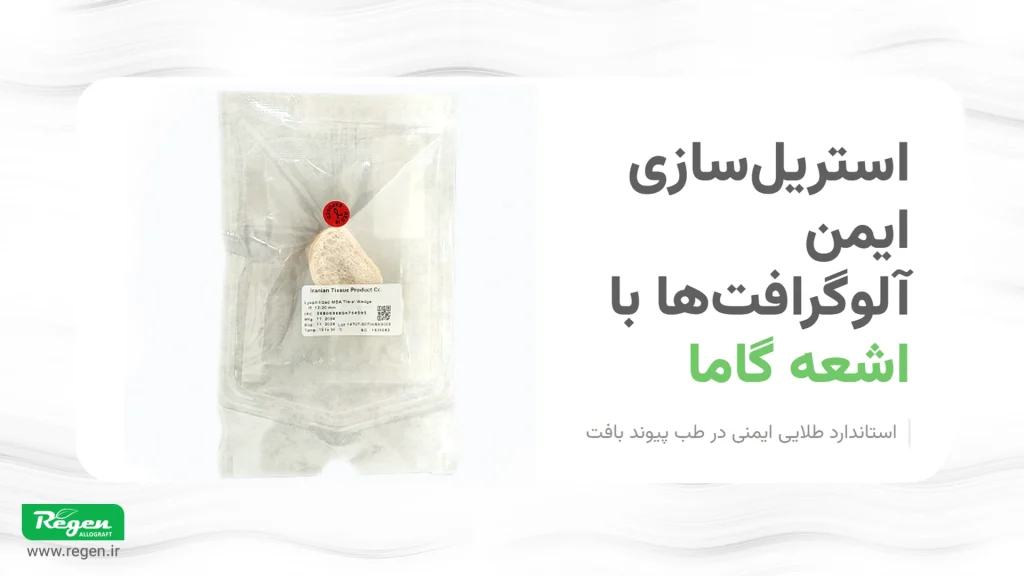 تصویر یک وج استخوان استریل شده با گاما با کاربرد های درمان پای پرانتزی و پا ضربدری