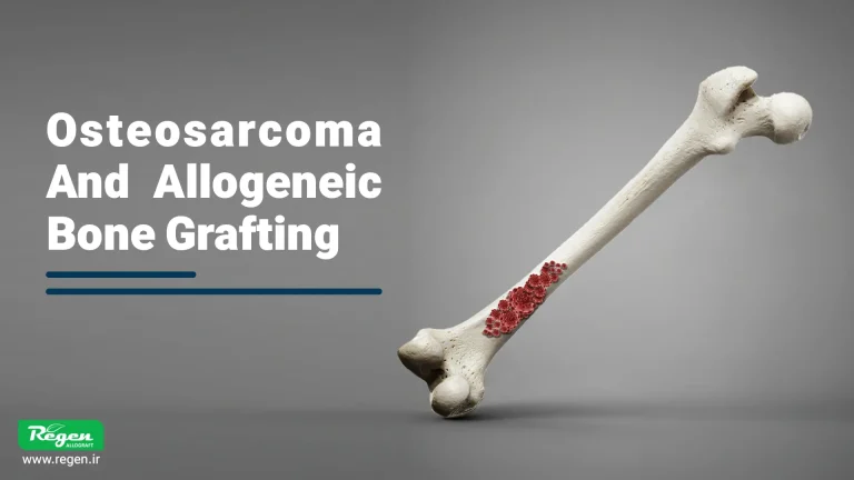 Osteosarcoma