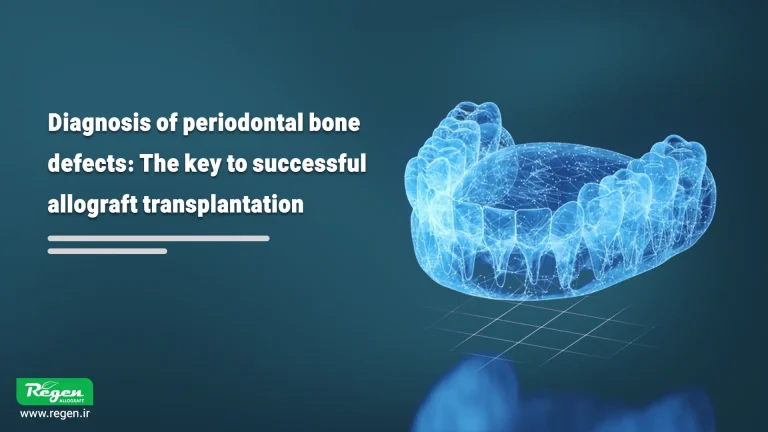 Diagnosis of periodontal bone defects: The key to successful allograft transplantation