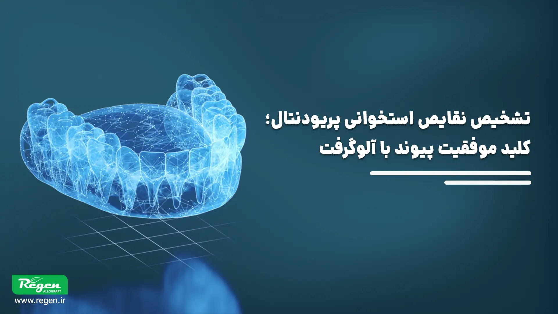 تشخیص نقایص استخوانی پریودنتال؛ کلید موفقیت پیوند با آلوگرفت