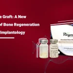 Bone Powder: The New Generation of Bone Regeneration Materials in Implantology Treatments