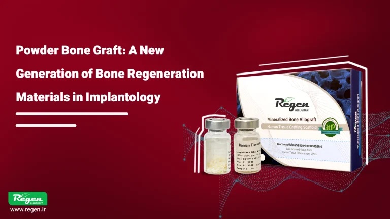 Bone Powder: The New Generation of Bone Regeneration Materials in Implantology Treatments