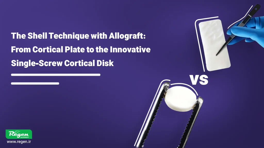 The Shell Technique in implantology, using dental cortical allograft blocks or plates, has been introduced as a powerful biomechanical solution to overcome this challenge.