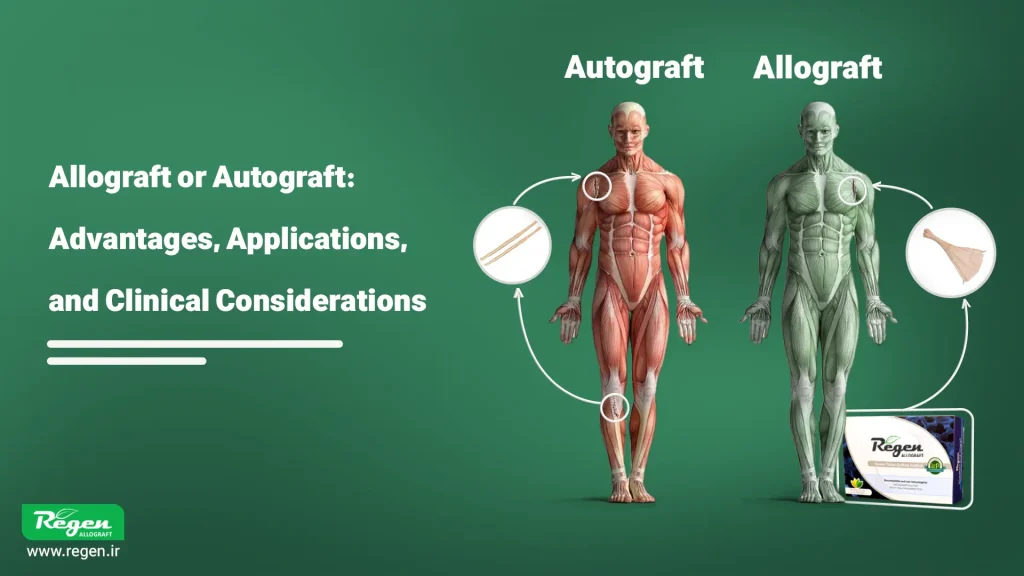 Allograft or Autograft: Advantages, Applications, and Clinical Considerations