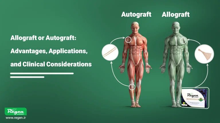 Allograft or Autograft: Advantages, Applications, and Clinical Considerations