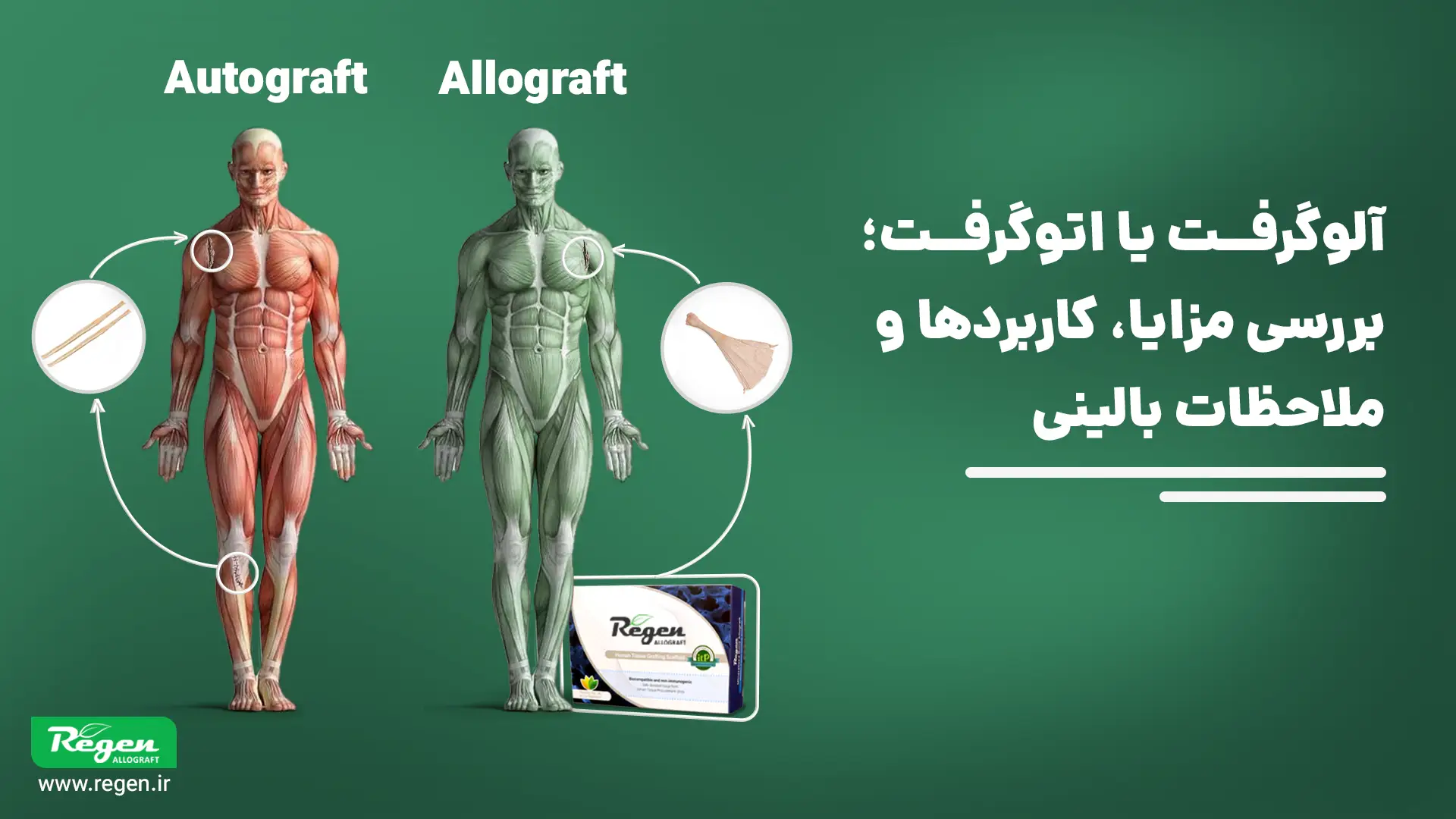 مقایسه تفضیلی استفاده از الوگرفت و اتوگرفت
