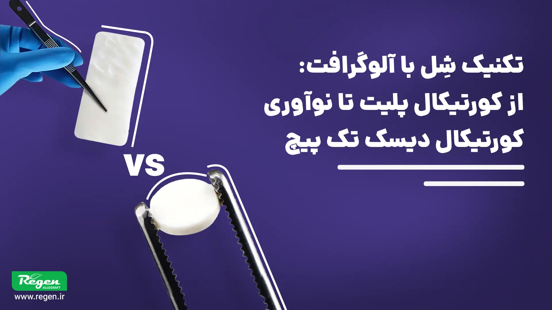 تکنیک شل با آلوگرافت؛ مقایسه کورتیکال پلیت و کورتیکال دیسک تکپیچ در بازسازی استخوان فک