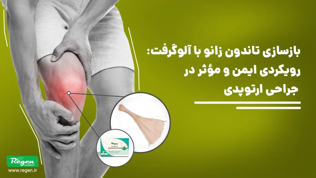 پارگی تاندون کشکک (Patellar Tendon Rupture) یکی از آسیب‌های نسبتاً نادر اما به‌شدت ازکارافتاده کننده سیستم اکستانسور زانو محسوب می‌شود؛ این تاندون نقشی اساسی در انتقال نیروی عضله چهارسر ران به کاسه‌زانو (پاتلا) و سپس به تیبیا دارد و هنگام اختلال در آن، توانایی صاف کردن زانو و تحمل وزن به‌طور چشمگیری کاهش می‌یابد.