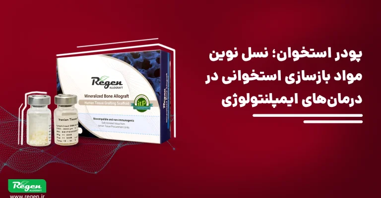 پودر استخوان در ایمپلنت دندانی