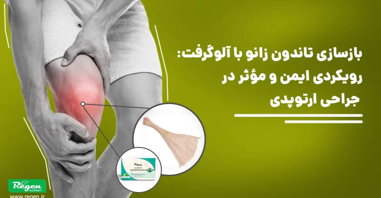 پارگی تاندون کشکک (Patellar Tendon Rupture) یکی از آسیب‌های نسبتاً نادر اما به‌شدت ازکارافتاده کننده سیستم اکستانسور زانو محسوب می‌شود؛ این تاندون نقشی اساسی در انتقال نیروی عضله چهارسر ران به کاسه‌زانو (پاتلا) و سپس به تیبیا دارد و هنگام اختلال در آن، توانایی صاف کردن زانو و تحمل وزن به‌طور چشمگیری کاهش می‌یابد.
