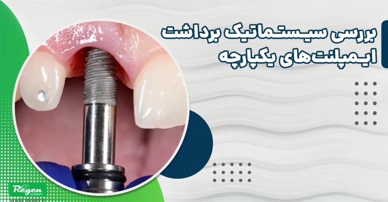 خارج سازی ایمپلنت