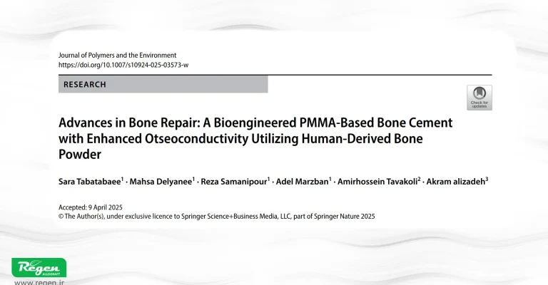 Enhanced PMMA bone cement with allograft bone powder demonstrates improved mechanical strength and osteoconductivity, paving the way for advanced orthopedic treatments.