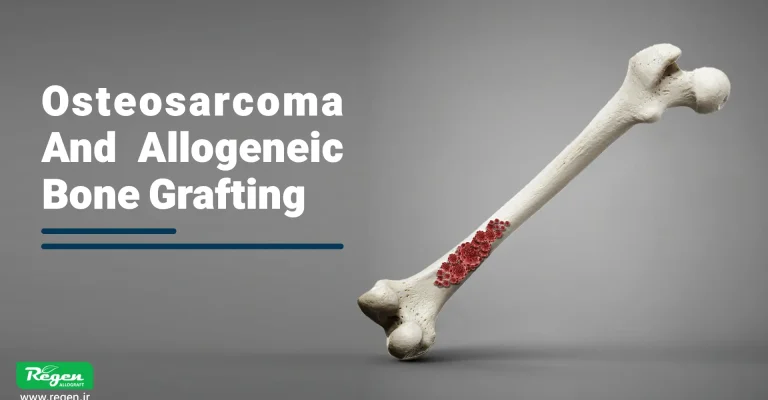 Osteosarcoma