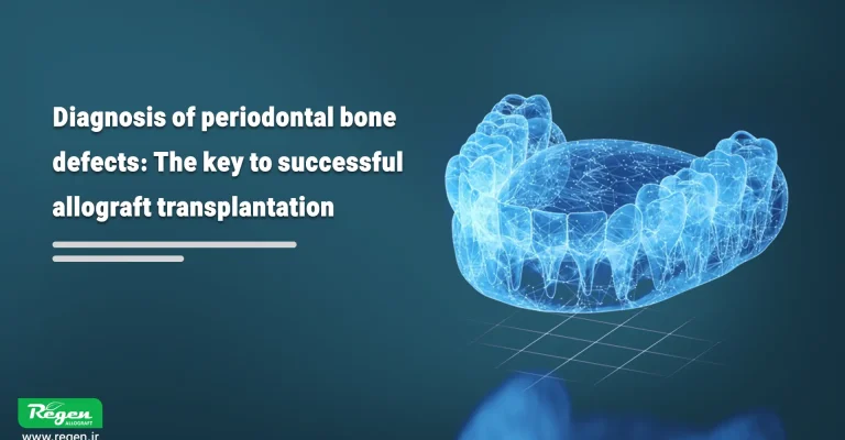 Diagnosis of periodontal bone defects: The key to successful allograft transplantation