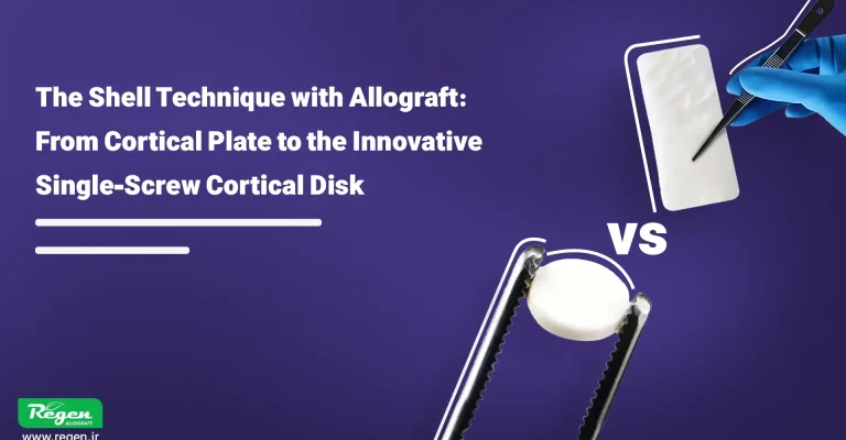 The Shell Technique in implantology, using dental cortical allograft blocks or plates, has been introduced as a powerful biomechanical solution to overcome this challenge.