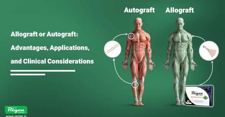 Allograft or Autograft: Advantages, Applications, and Clinical Considerations