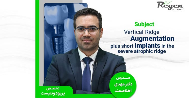 تحلیل استخوان فک و ایمپلنت آلوگرافت