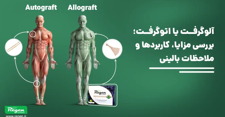 مقایسه تفضیلی استفاده از الوگرفت و اتوگرفت