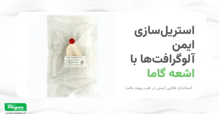 تصویر یک وج استخوان استریل شده با گاما با کاربرد های درمان پای پرانتزی و پا ضربدری